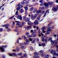 PTGIS antibody