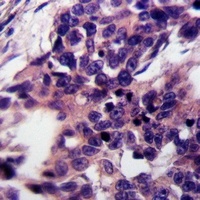 PTGIS Rabbit Polyclonal Antibody