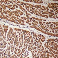 Anti-Podocan Antibody