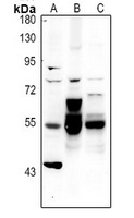 Alpha-internexin Antibody
