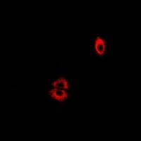Anti-5-HT4 Antibody