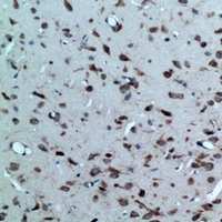 CRHR2 antibody