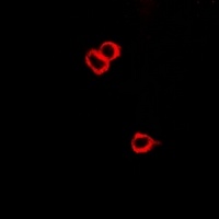 Anti-CRHR2 Antibody