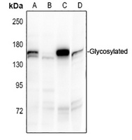 Anti-EMR1 Antibody