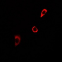 Anti-Endothelin A Receptor Antibody