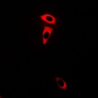 Frizzled 3 Rabbit Polyclonal Antibody