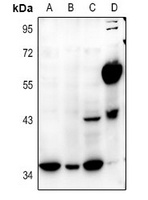 E2F5 Rabbit Polyclonal Antibody