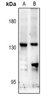 NMDAR2C Rabbit Polyclonal Antibody