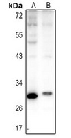 Carbonic Anhydrase 1 Antibody