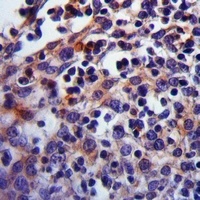Carbonic Anhydrase 1 Antibody