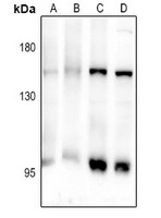 CD103 Rabbit Polyclonal Antibody