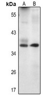 Livin Antibody