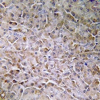 Anti-Semaphorin 3C Antibody
