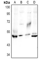 Granulin Rabbit Polyclonal Antibody