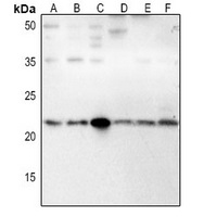 IFN beta Rabbit Polyclonal Antibody