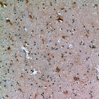 IFN beta Rabbit Polyclonal Antibody