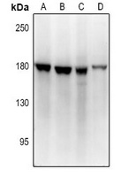 BMP1 Rabbit Polyclonal Antibody