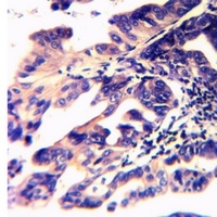 Anti-BACE1 (Acetyl-K316) Antibody