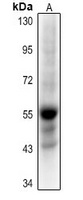 Histone Deacetylase 1 (Acetyl-K220) Rabbit Polyclonal Antibody