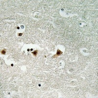 DNA-PKcs (Phospho-S2612) Antibody