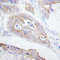 Anti-CD45 Antibody
