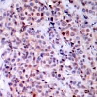 NF-kappaB p65 Rabbit Polyclonal Antibody