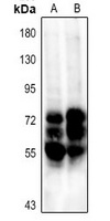 TAU Rabbit Polyclonal Antibody