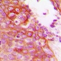 Anti-GAB2 Antibody