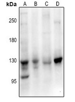 EPHB1/2/3 Antibody