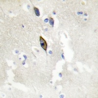 Anti-EPHB1/2/3 Antibody