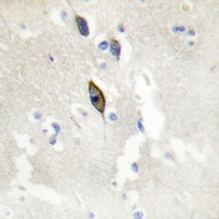 EPHB1/2/3 antibody