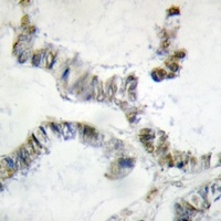 Anti-HMGXB3 Antibody