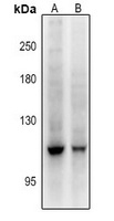 DGK zeta Rabbit Polyclonal Antibody