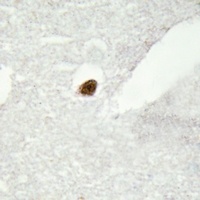 Anti-DGK zeta Antibody