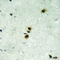 Anti-MXD4 Antibody