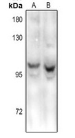 HPC2 Rabbit Polyclonal Antibody