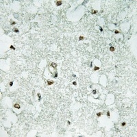 HPC2 Rabbit Polyclonal Antibody