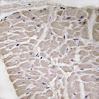 Collagen 16 alpha 1 Antibody