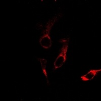 Laminin alpha 3 antibody