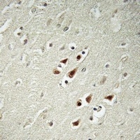Anti-ABHD14B Antibody