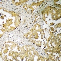 Anti-ADAMTS16 Antibody
