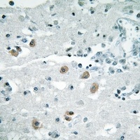 Anti-PLA2G4D Antibody