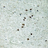 Anti-REXO1 Antibody