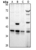 RALY Rabbit Polyclonal Antibody