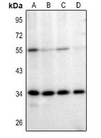 Mindin Rabbit Polyclonal Antibody
