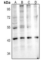 IL-11RA Rabbit Polyclonal Antibody