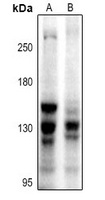 BUB1 Rabbit Polyclonal Antibody