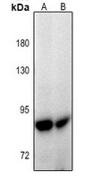 PKC gamma Rabbit Polyclonal Antibody