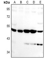 VASH1 Rabbit Polyclonal Antibody