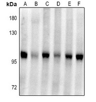 Plasminogen Rabbit Polyclonal Antibody